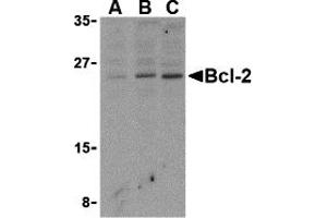 Western Blotting (WB) image for anti-B-Cell CLL/lymphoma 2 (BCL2) (N-Term) antibody (ABIN1031266) (Bcl-2 antibody  (N-Term))