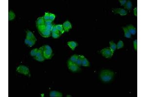 Immunofluorescence staining of MCF-7 cells with ABIN7143943 at 1:100, counter-stained with DAPI. (SNCA antibody  (AA 1-140))
