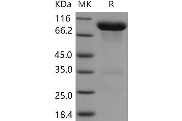 VNN1 Protein (Fc Tag)
