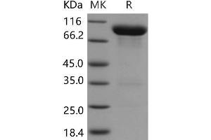 Western Blotting (WB) image for Vanin 1 (VNN1) protein (Fc Tag) (ABIN7320102)