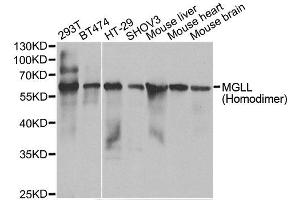Western blot analysis of extracts of various cell lines, using MGLL antibody. (MGLL antibody)