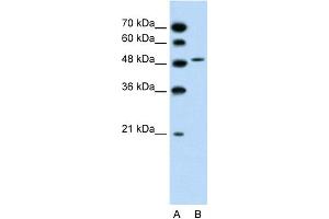 WB Suggested Anti-SLC10A5 Antibody Titration:  1. (SLC10A5 antibody  (C-Term))