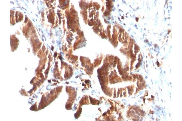 TOP1MT antibody