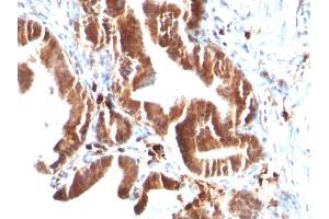 Formalin-fixed, paraffin-embedded human Gallbladder stained with Topo I, MT Mouse Monoclonal Antibody (TOP1MT/488). (TOP1MT antibody)