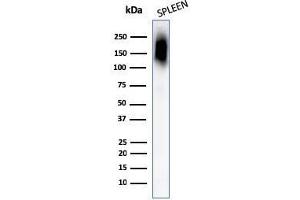 Western Blotting (WB) image for anti-Protein tyrosine Phosphatase, Receptor Type, C (PTPRC) antibody (ABIN6940442)