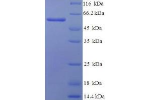 SDS-PAGE (SDS) image for Poly(A) Binding Protein, Cytoplasmic 1 (PABPC1) (AA 1-370), (partial) protein (His-SUMO Tag) (ABIN5710061) (PABP Protein (AA 1-370, partial) (His-SUMO Tag))