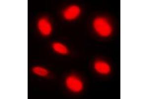 Immunofluorescent analysis of BAF250B staining in HeLa cells. (ARID1B antibody  (Center))