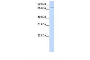 Image no. 1 for anti-Ubiquitin Associated and SH3 Domain Containing, A (UBASH3A) (AA 434-483) antibody (ABIN6738187) (UBASH3A antibody  (AA 434-483))