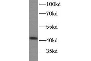 WB analysis of HeLa cells subjected to SDS-PAGE, using SPOP antibody (1/500 dilution). (SPOP-B antibody)