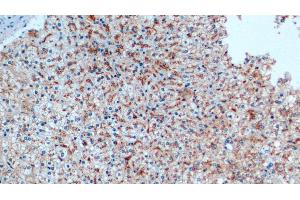 Immunohistochemistry (IHC) image for anti-Cathepsin D (CTSD) (AA 21-412) antibody (ABIN7426250)