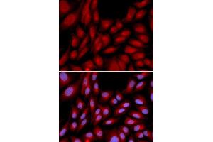 Immunofluorescence analysis of U2OS cell using BAG1 antibody. (BAG1 antibody  (AA 1-230))