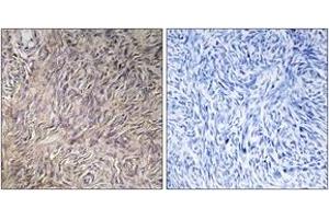 Immunohistochemistry (IHC) image for anti-Fibroblast Growth Factor 22 (FGF22) (AA 71-120) antibody (ABIN2889960) (FGF22 antibody  (AA 71-120))