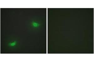 Immunofluorescence analysis of HepG2 cells, using DUSP16 Antibody. (DUSP16 antibody  (AA 571-620))