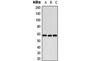 Western blot analysis of Cytochrome P450 8B1 expression in K562 (A), SP2/0 (B), PC12 (C) whole cell lysates. (CYP8B1 antibody  (Center))