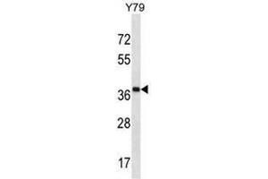 Western Blotting (WB) image for anti-CAP-GLY Domain Containing Linker Protein Family, Member 4 (CLIP4) (AA 332-361), (Middle Region) antibody (ABIN951571)