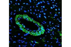 IF analysis of TAGLN/Transgelin using anti-TAGLN/Transgelin antibody (ABIN7600099). (Transgelin antibody  (AA 15-170))