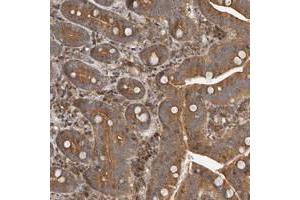 Immunohistochemical staining of human duodenum with COLEC11 polyclonal antibody  shows moderate cytoplasmic positivity in glandular cells at 1:200-1:500 dilution.