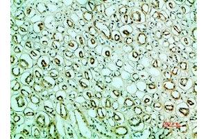 Immunohistochemical analysis of paraffin-embedded human-kidney, antibody was diluted at 1:200 (IRF3 antibody  (AA 1268-1341))