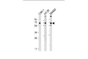All lanes : Anti-SLC23A1 Antibody (N-term) at 1:1000-1:2000 dilution Lane 1: Caki-1 whole cell lysate Lane 2: HT-29 whole cell lysate Lane 3: S whole cell lysate Lysates/proteins at 20 μg per lane. (SLC23A1 antibody  (N-Term))