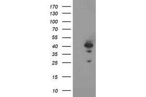 HEK293T cells were transfected with the pCMV6-ENTRY control (Left lane) or pCMV6-ENTRY RAD51L1 (Right lane) cDNA for 48 hrs and lysed. (RAD51 Homolog B antibody  (AA 119-346))