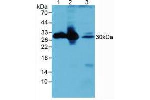 Figure. (CALB1 antibody  (AA 3-261))