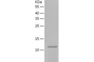 phosphohistidine Phosphatase 1 (PHPT1) (AA 1-125) protein (His-IF2DI Tag)
