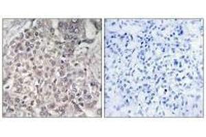 CYP4F2 antibody  (N-Term)