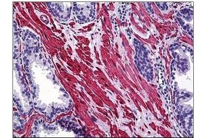 Immunohistochemistry (IHC) image for anti-SMAD Specific E3 Ubiquitin Protein Ligase 1 (SMURF1) antibody (ABIN781919) (SMURF1 antibody)