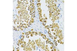 Immunohistochemistry of paraffin-embedded mouse testis using PIWIL1 antibody. (PIWIL1 antibody)
