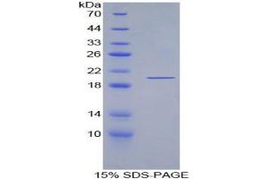 SDS-PAGE analysis of ECP Protein. (Ecotin Protein)