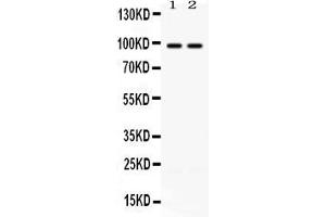 Western blot analysis of ABR expression in rat brain extract ( Lane 1) and mouse brain extract ( Lane 2). (ABR antibody  (Middle Region))