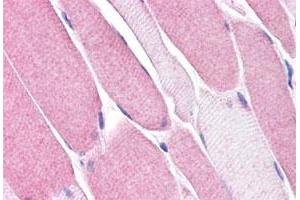 Immunohistochemistry (Formalin/PFA-fixed paraffin-embedded sections) of human skeletal muscle tissue with BEST3 polyclonal antibody . (Bestrophin 3 antibody  (Internal Region))