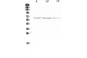 Western blot analysis of NOX2 using anti-NOX2 antibody . (CYBB antibody  (AA 416-500))