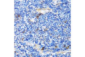 Immunohistochemistry of paraffin-embedded Human tonsil using PTCH1 antibody (ABIN1682368, ABIN1682367, ABIN3015342, ABIN3015343 and ABIN6213997) at dilution of 1:100 (40x lens). (Patched 1 antibody  (AA 1214-1312))