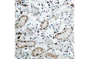 Immunohistochemical analysis of DCP1A staining in human kidney formalin fixed paraffin embedded tissue section. (DCP1A antibody)