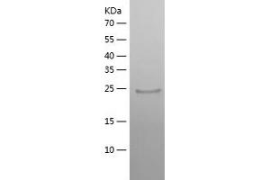 IL22RA2 Protein (AA 22-231) (His tag)