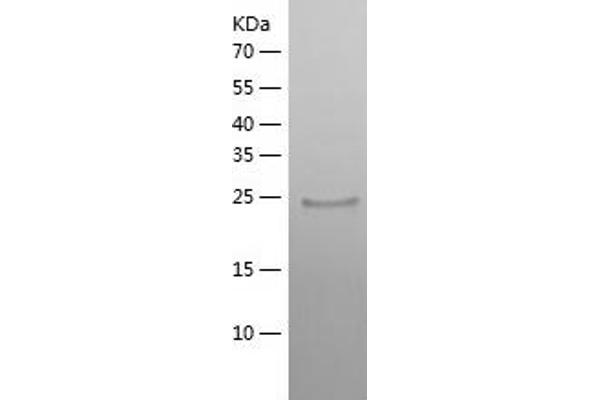 IL22RA2 Protein (AA 22-231) (His tag)