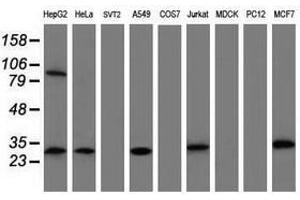 Image no. 4 for anti-Mitochondrial Translational Initiation Factor 3 (MTIF3) (AA 56-278) antibody (ABIN1491590) (MTIF3 antibody  (AA 56-278))