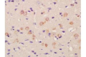 Formalin-fixed and paraffin embedded rat brain labeled with Rabbit Anti-FLRT2 Polyclonal Antibody, Unconjugated  at 1:200 followed by conjugation to the secondary antibody and DAB staining (FLRT2 antibody  (AA 201-300))