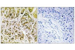 Immunohistochemistry (IHC) image for anti-SMAD, Mothers Against DPP Homolog 1 (SMAD1) (pSer187) antibody (ABIN1847368) (SMAD1 antibody  (pSer187))