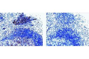 c-Cbl (pY774) staining on tonsil. (CBL antibody  (pTyr774))