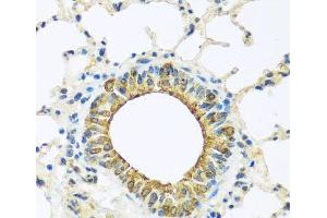 Immunohistochemistry of paraffin-embedded Mouse lung using DCP2 Polyclonal Antibody at dilution of 1:100 (40x lens).