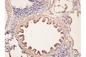 Formalin-fixed and paraffin embedded rat lung labeled with Rabbit Anti-Glycophorin C Polyclonal Antibody, Unconjugated (ABIN718991) at 1:200 followed by conjugation to the secondary antibody and DAB staining (CD236/GYPC antibody  (AA 31-128))
