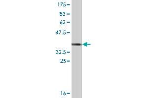 Western Blot detection against Immunogen (36. (HS6ST1 antibody  (AA 303-401))