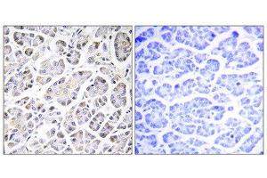 Immunohistochemistry (IHC) image for anti-ATP Synthase, H+ Transporting, Mitochondrial Fo Complex, Subunit C3 (Subunit 9) (ATP5G3) (N-Term) antibody (ABIN1850826) (ATP5G3 antibody  (N-Term))