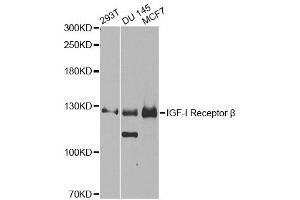 Western blot analysis of extracts of various cell lines, using IGF1R antibody (ABIN5970073) at 1/1000 dilution. (IGF1R antibody  (N-Term))