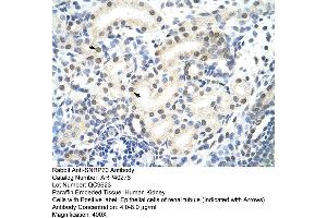 Rabbit Anti-SNRP70 Antibody  Paraffin Embedded Tissue: Human Kidney Cellular Data: Epithelial cells of renal tubule Antibody Concentration: 4. (SNRNP70 antibody  (N-Term))