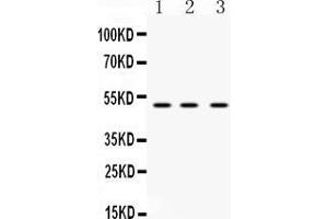Western Blotting (WB) image for anti-Tumor Necrosis Factor Receptor Superfamily, Member 10a (TNFRSF10A) (AA 99-131), (N-Term) antibody (ABIN4886748)