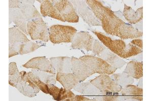 Immunoperoxidase of monoclonal antibody to CASQ2 on formalin-fixed paraffin-embedded human skeletal muscle. (CASQ2 antibody  (AA 20-399))