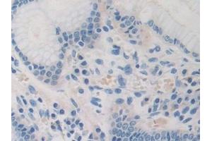 Detection of PDHX in Human Stomach Tissue using Polyclonal Antibody to Pyruvate Dehydrogenase Complex Component X (PDHX)